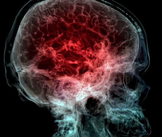 Un estudio descubre niveles alarmantes de microplásticos en el cerebro